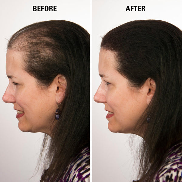 Eclipse Instant Hair Filler for Women & Men (3 sizes)